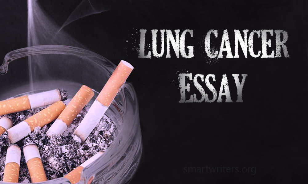 Lung cancer essay